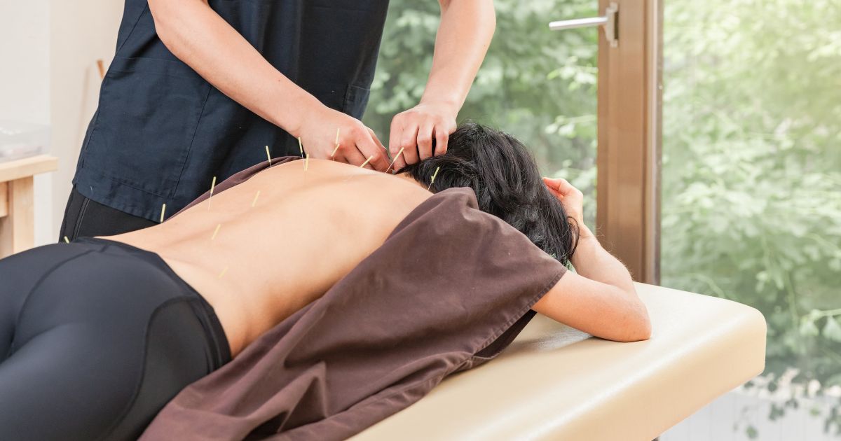 針灸師